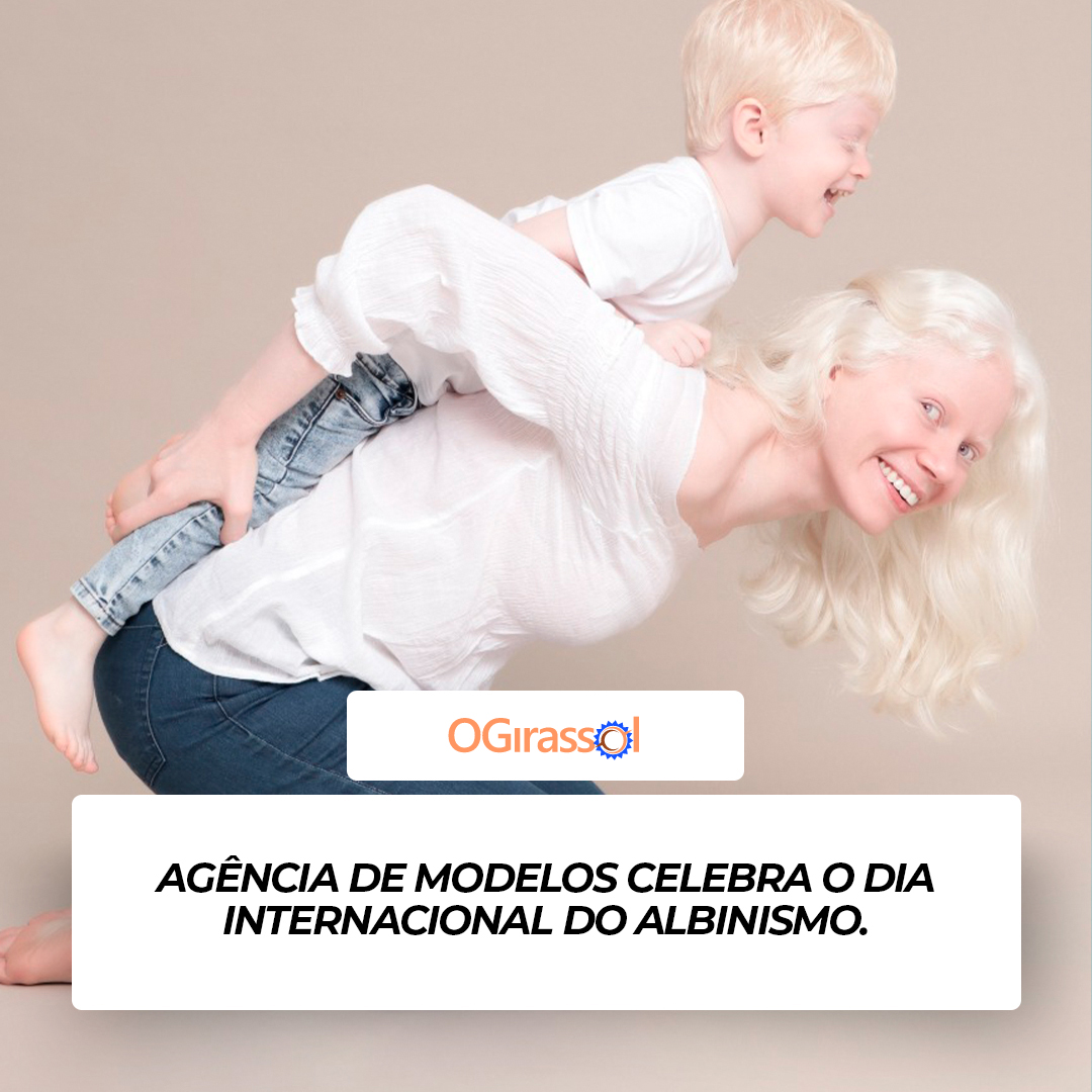 Agência de modelos celebra o Dia Internacional do Albinismo